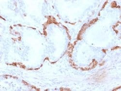 Cytokeratin 14 Antibody (KRT14/2375) - Azide and BSA Free, Novus Biologicals 100 &mu;g | Buy Online | Novus Biologicals | Fisher Scientific